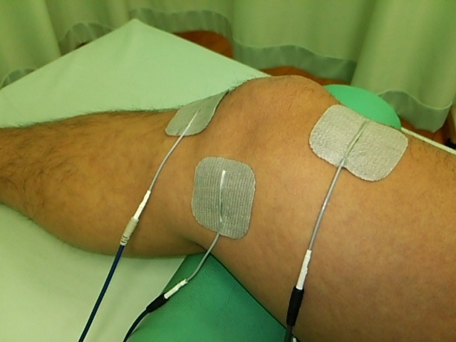 練馬区でひざの痛み 水が溜まる症状 オスグッドなどの治療なら江古田の整骨院 手塚接骨院 練馬区