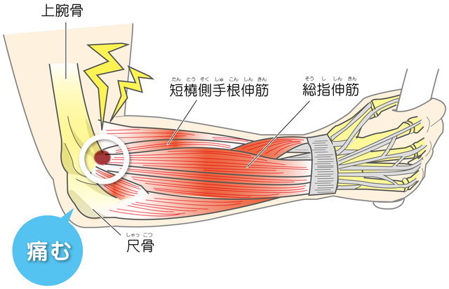どのような症状がありますか?