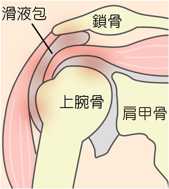 練馬区で肩の痛み 五十肩 急な肩の痛みの治療なら江古田の整骨院 手塚接骨院 練馬区 練馬区で肩の痛み 五十肩 急な肩の痛みの治療なら江古田の整骨院 手塚接骨院 練馬区